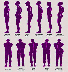 Posture Chart